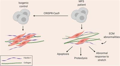 Aortic “Disease-in-a-Dish”: Mechanistic Insights and Drug Development Using iPSC-Based Disease Modeling